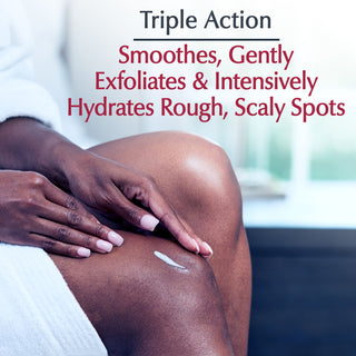 Eucerin Roughness Relief Spot Treatment, Fragrance Free, 2.5 oz Tube - By Baano