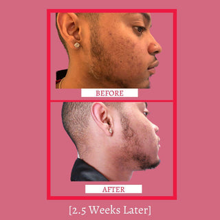 Mini Set - Travel Size - Glass Skin Set