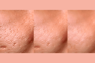 Ultra-Advanced Anti-Aging Daily Resurfacing Pads