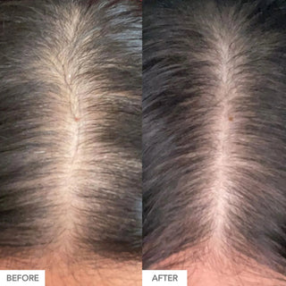 Advanced Formula - By Baano