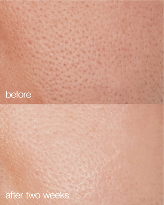 Biome Boost Cream Daily Moisturizer