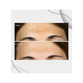 Dermalogica Powerbright Dark Spot Serum 30 ml - By Baano