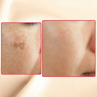 The Eraser Spot Cream | Dark Spot Corrector