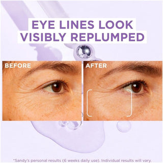 Loreal Paris Serum Revitalift Filler Hyaluronic Acid Eye Serum 20 ml 2 Pack - By Baano