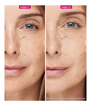 Nivea Luminous 630 Anti Dark Spot Night Cream 50ml / 1.7 fl oz - 3 Pack Chivela