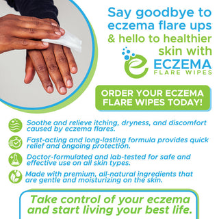 Eczema Flare Wipes® pH Select