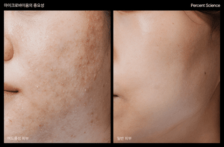 PERCENT SCIENCE Dexynol-16.3 Serum 1.6 Oz. - Acne/Trouble