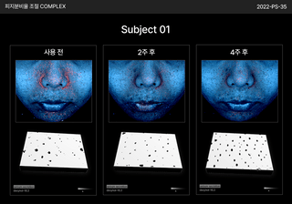 PERCENT SCIENCE Dexynol-16.3 Cream 2 Oz. - Acne/Trouble