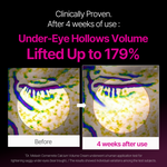 Dr. Melaxin Cemenrete Calcium Volume Ampoule Plus - By Baano