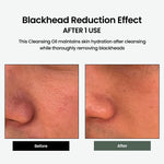 Liposome Daily Cleansing Oil, Gentle Makeup & Blackhead Remover for Sensitive Skin with Centella Asiatica TECA, Korean Skincare for Trouble Care (6.76 Fl. Oz., 200Ml)