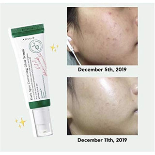 AXIS-Y Dark Spot Correcting Glow Serum - By Baano
