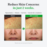 Dr. Althea Gentle Vitamin C Serum