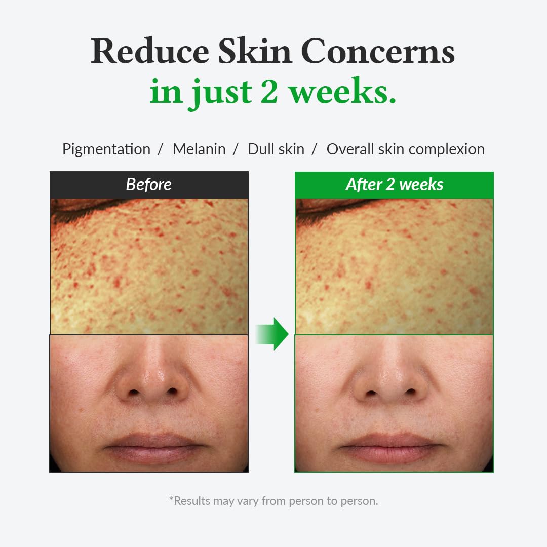 Dr. Althea Gentle Vitamin C Serum