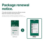 SOME BY MI Clear Spot Patch