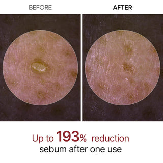 Dr. Melaxin Peel Shot Exfoliant Black Rice Ampoule - By Baano