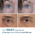 Dr. Melaxin Eyephalt Eyebag Cream - By Baano