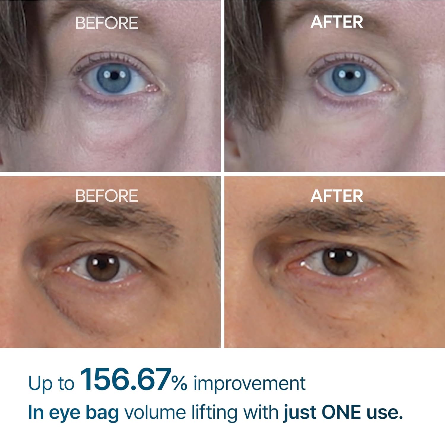 Dr. Melaxin Eyephalt Eyebag Cream - By Baano