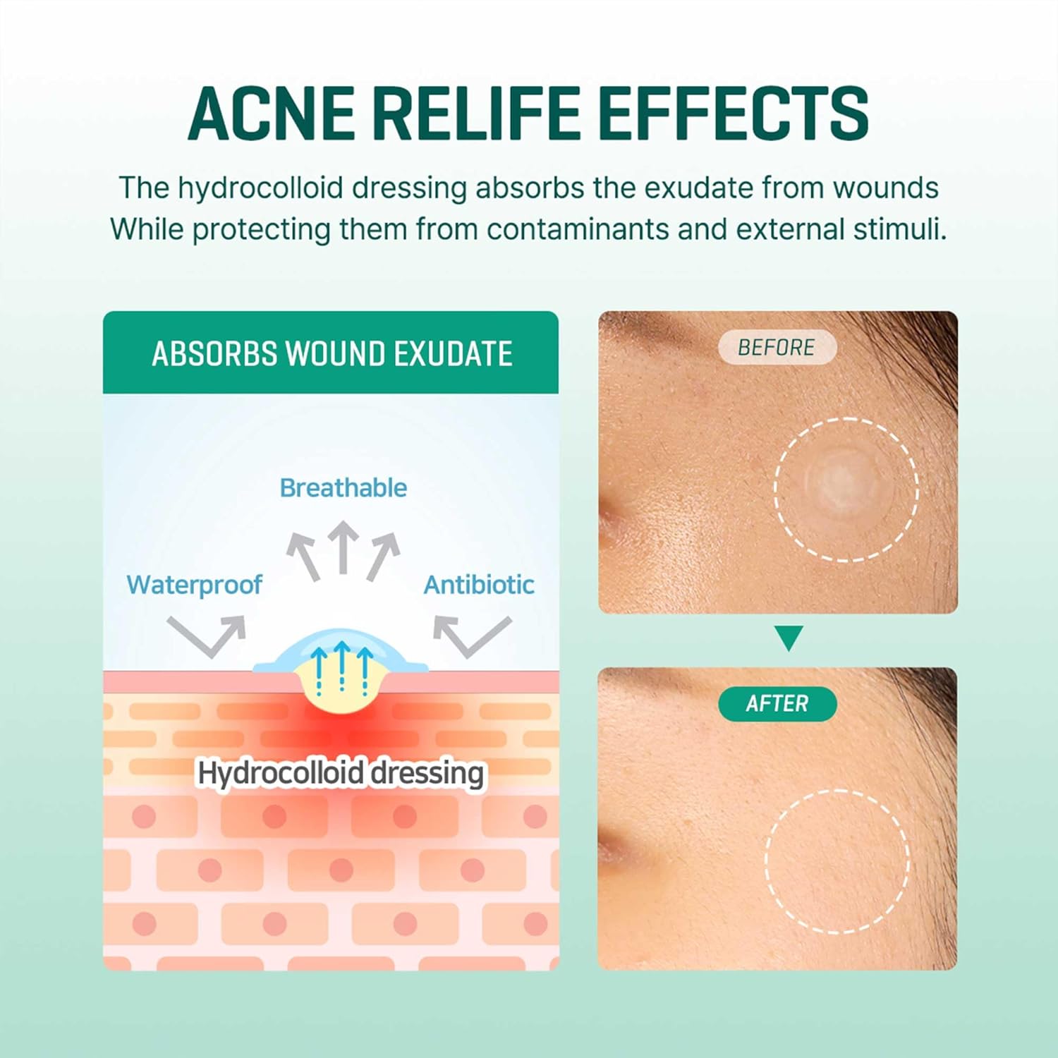 SOME BY MI Clear Spot Patch