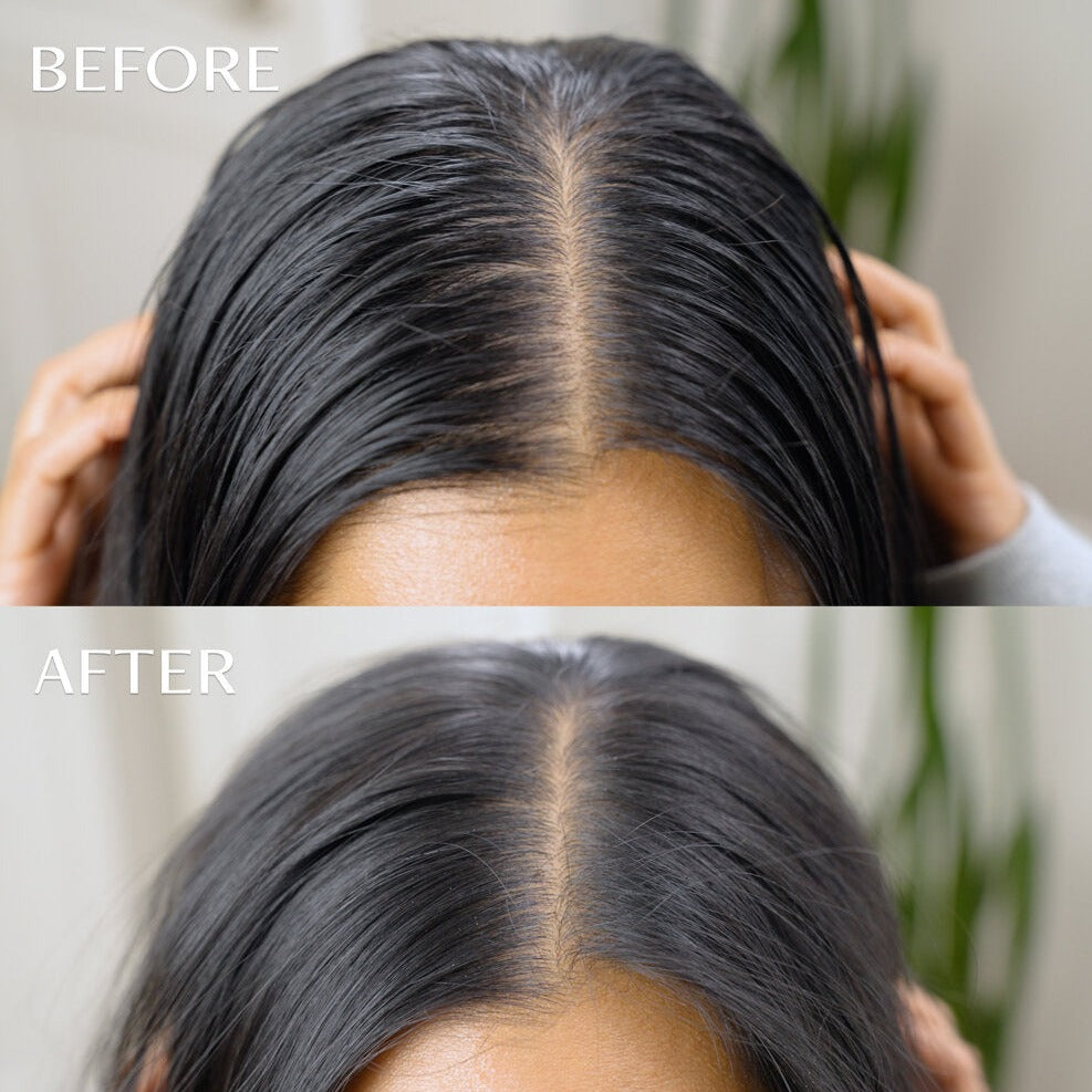 Day After™ Brush + Refill Bundle Clean Dry Shampoo