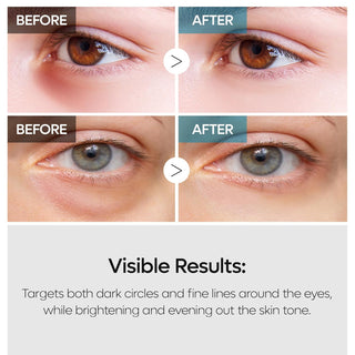 Dr. Melaxin TX Retinalsome Double Effect Eye Cream - By Baano