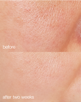 Biome Boost Cream Daily Moisturizer