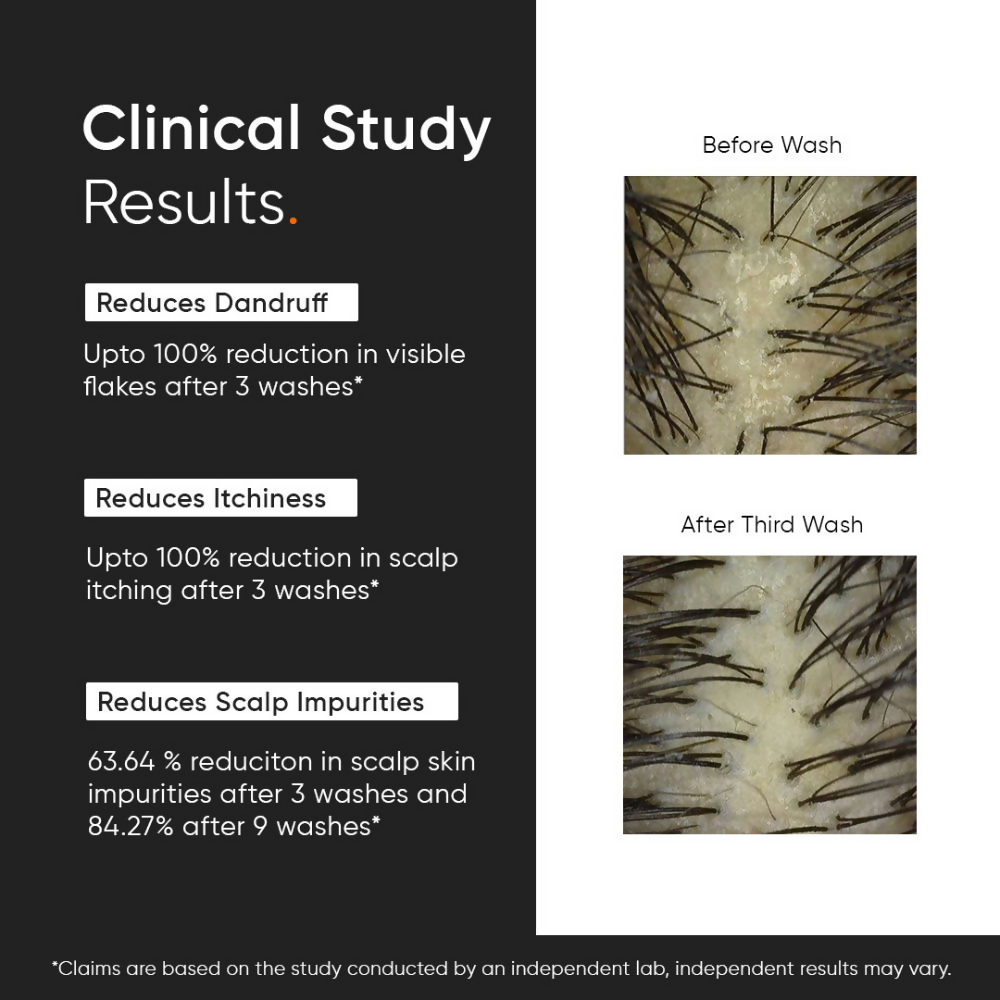 Minimalist Anti-Dandruff Shampoo 3.5% Salicylic Acid