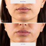 BioRepublic SkinCare Lip Masks 6pk - New