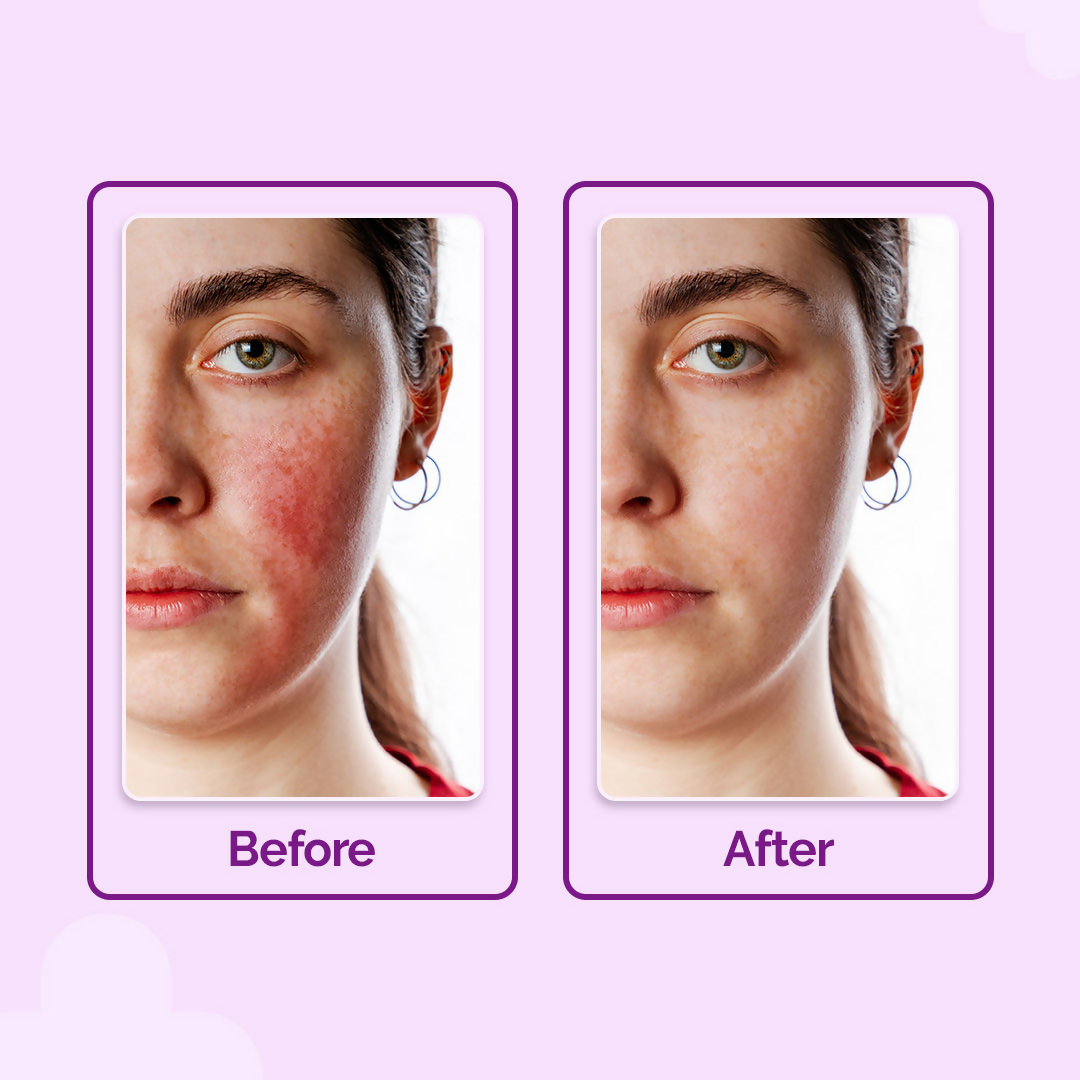 Texte alternatif par défaut