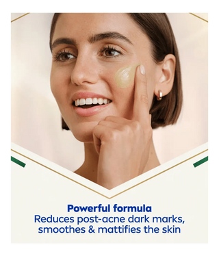 Nivea Luminous 630 Post-Acne Mark Skin Perfecting Serum 30ml / 1 fl.oz