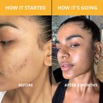 Turmeric + Vitamin C Serum