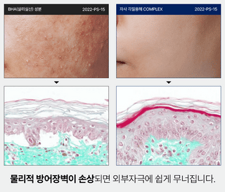 PERCENT SCIENCE Dexynol-16.3 Booster Skin Essence 4.7 Oz. - Acne/Trouble