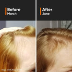 Minimalist Hair Growth Actives 18%