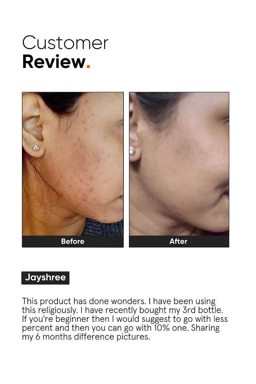 Minimalist 10% Niacinamide Face Serum