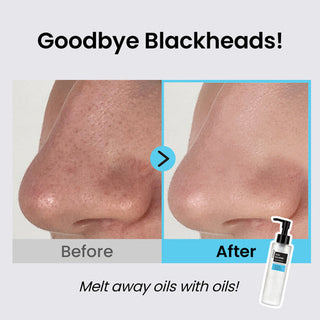 Coxir Ultra Hyaluronic Cleansing Oil - By Baano