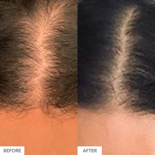 Gummy Stars - By Baano